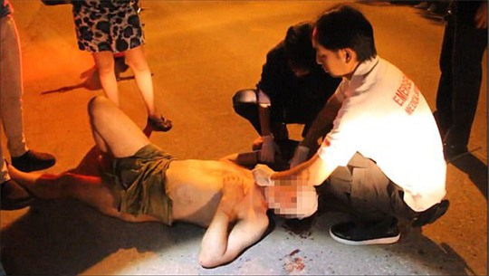 Du khách Anh khỏa thân rơi lầu khách sạn - Ảnh 1.