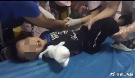 Vấp ngã khi đi ngược chiều, bé trai 4 tuổi bị thang cuốn nghiến đứt lìa cánh tay - Ảnh 2.