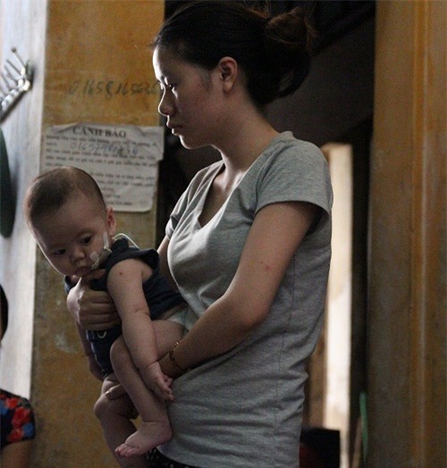 thuong tam nhung benh nhi vat lon voi nang nong hon 40 do o xom tro ngheo - 12