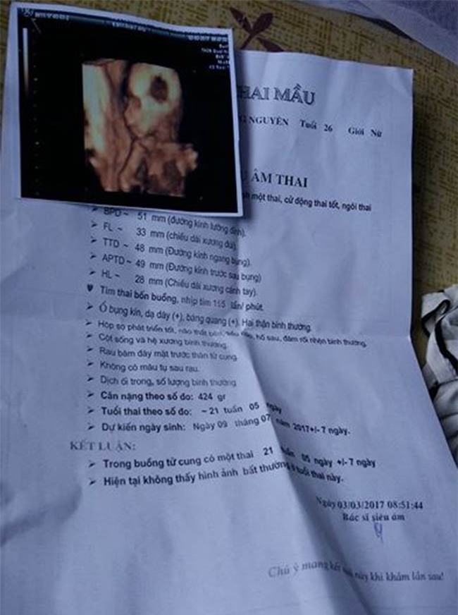 8 nam tui nhuc truoc bao loi de biu, cap vo chong bat ngo nhan cai ket ngot lim - 1