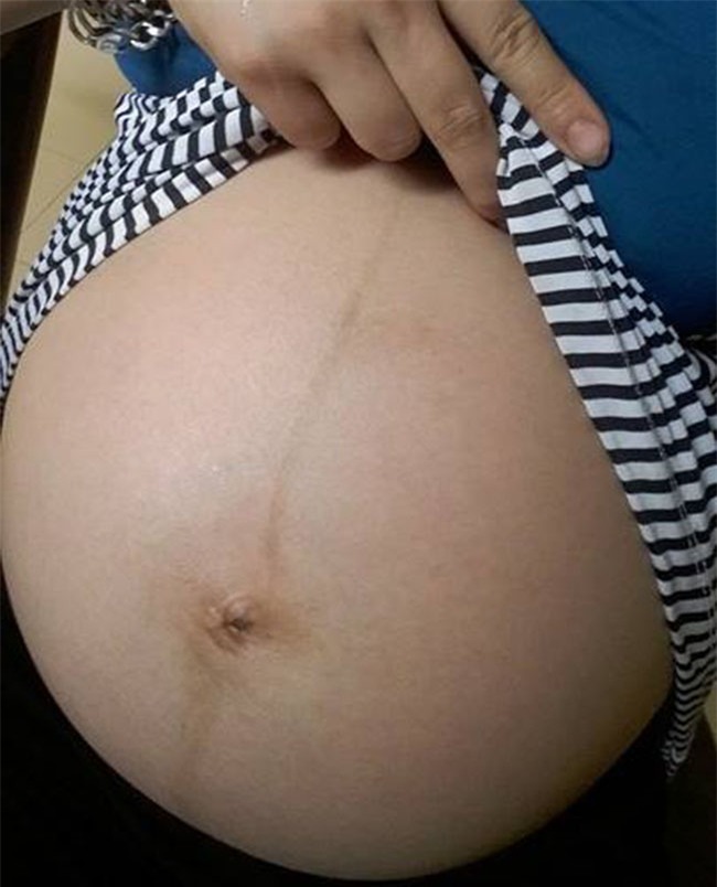 8 nam tui nhuc truoc bao loi de biu, cap vo chong bat ngo nhan cai ket ngot lim - 2