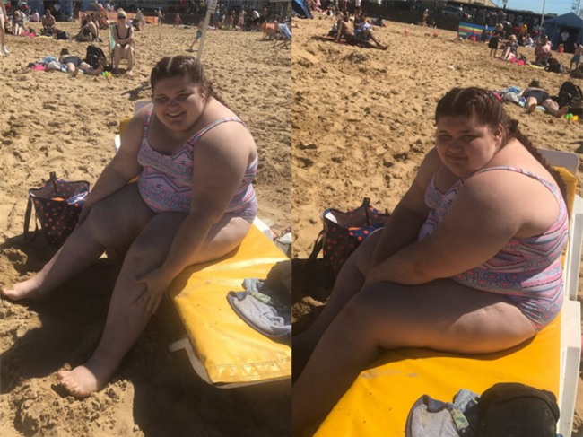 Bi bat nat vi beo, co gai quyet tam mac bikini ra bien hinh anh 1