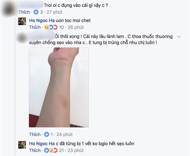 Tay bị bỏng, Hồ Ngọc Hà buồn bã cầu cứu cộng đồng mạng - Ảnh 2.