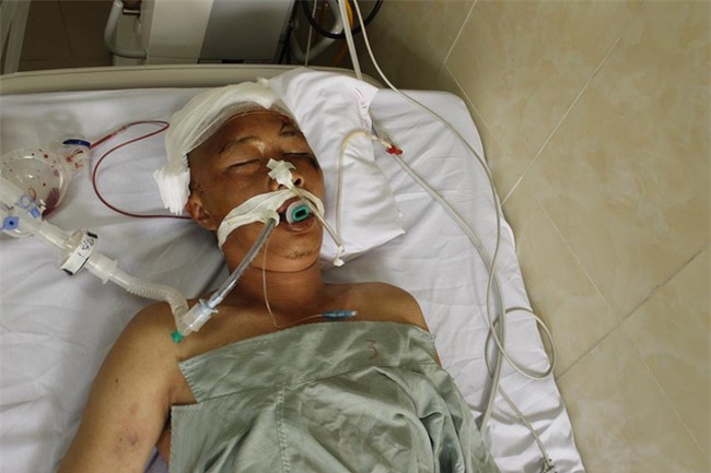 Bệnh nhân hôn mê sâu đang nằm tại Bệnh viện E không có người nhà đến nhận - Ảnh 1.