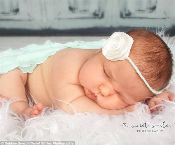 mang bau me tang can rat it nhung luc mo de, bac si da soc khi thay em be the nay - 4