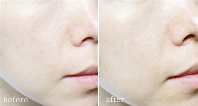 5 loại kem chống nắng Hàn Quốc giúp da giảm ngay 5 độ C khi thoa lên mặt - Ảnh 4.