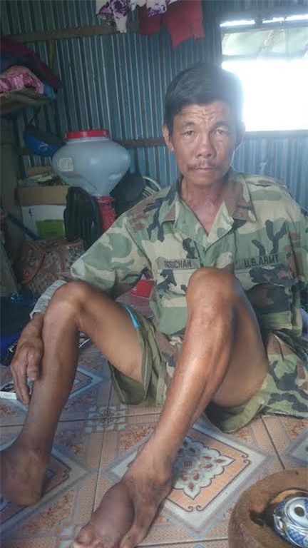 Ông Tám chỉ vết thương đầy trên cơ thể từ những vụ tai nạn liên tiếp.