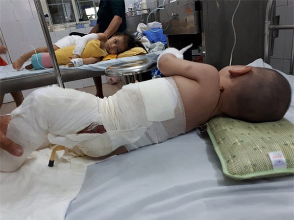 me cam diec, bo mu loa, con trai 10 thang tuoi nguy kich vi bong nang - 2