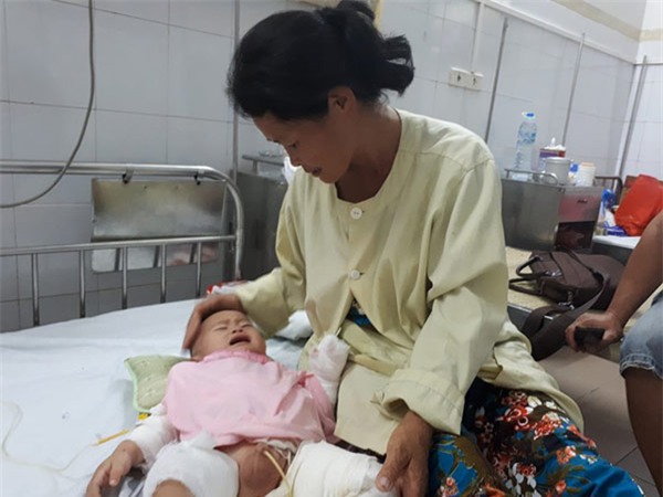 me cam diec, bo mu loa, con trai 10 thang tuoi nguy kich vi bong nang - 3