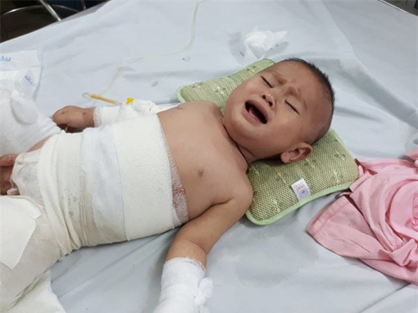 me cam diec, bo mu loa, con trai 10 thang tuoi nguy kich vi bong nang - 4