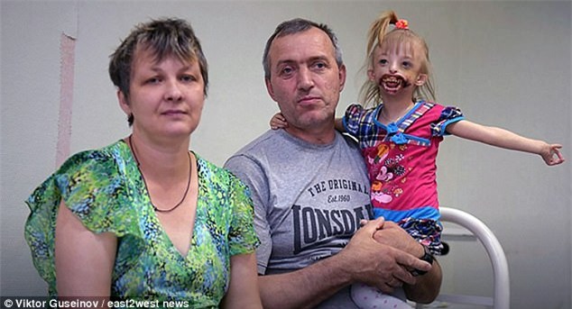 Bé gái bị xa lánh vì mắc dị tật miệng quỷ - Ảnh 3.