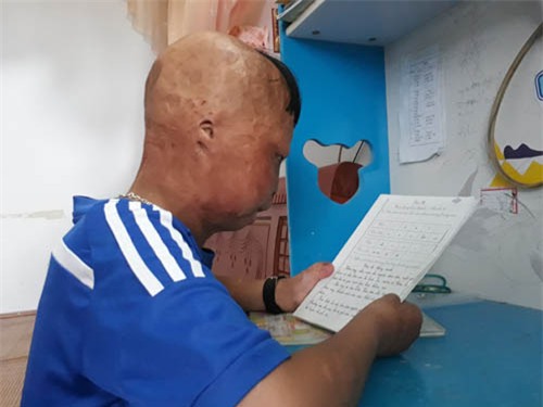 sau 6 nam, cau be bien dang vi bi cha ruot do xang dot gio ra sao? - 4