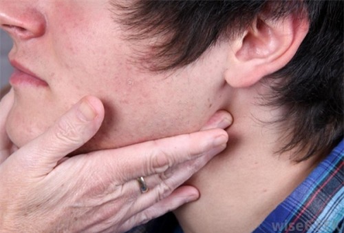 ung thư, ung thư vòm họng