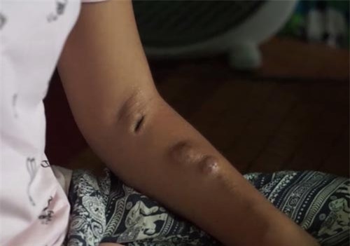 co gai ha noi 10 nam di vien chay than voi nhung uoc mo con dang do - 2