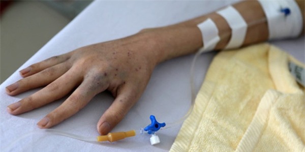 bat cu ai cung phai nho 9 dau hieu nay cua benh ung thu - 1