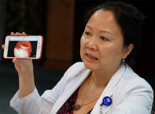 Suyt mat mang vi hoc xuong ca hinh anh 1