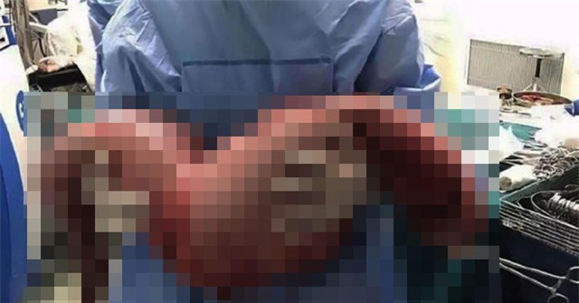 Cat bo doan ruot gia dai gan 1 m, nang 13 kg hinh anh 1