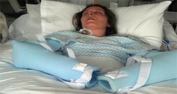 băng vệ sinh, sử dụng băng vệ sinh sai cách, sử dụng băng vệ sinh, kinh nguyệt