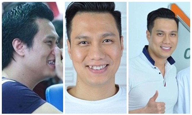 fan tiec nuoi nu cuoi rang khenh cua viet anh "nguoi phan xu" - 1