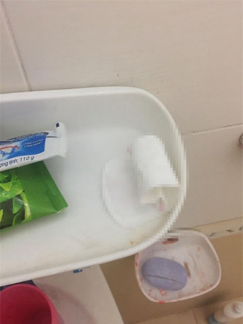 bạn dan nguoi yeu ve phong tro o, nam sinh bong dung bị "dá" keu troi: "tao da lam gi sai?" - 2