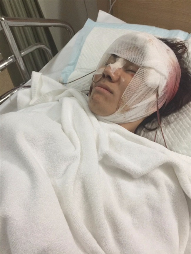 Sau khi “đập mặt đi xây lại”, chàng trai xấu xí hóa cô gái hoàn hảo rồi có luôn bồ đẹp như trai Hàn Quốc - Ảnh 5.