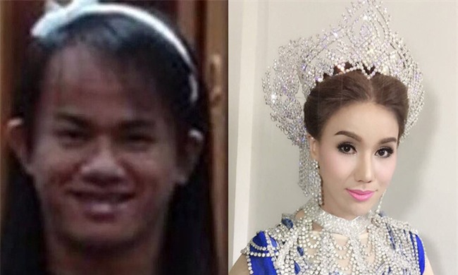 Sau khi “đập mặt đi xây lại”, chàng trai xấu xí hóa cô gái hoàn hảo rồi có luôn bồ đẹp như trai Hàn Quốc - Ảnh 6.