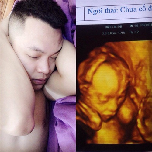 tuc chong ruou say le nhe ca dem, vo tre bau bi lam dieu nay khien chong so den gia - 4