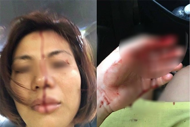 Hà Nội: Người phụ nữ tố bị chồng cũ đánh đập, bạo hành dã man - Ảnh 1.
