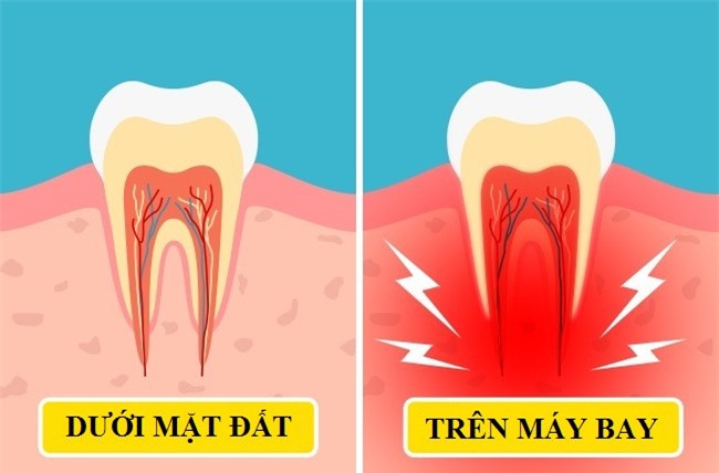 Nhung dieu ky la xay ra voi co the khi di may bay hinh anh 8