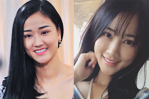 Sau 22 ngày phẫu thuật thẩm mỹ, khuôn mặt Maya khiến nhiều người không nhận ra - Ảnh 7.