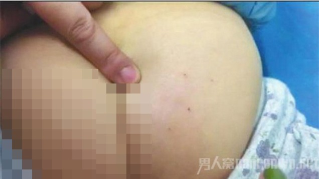 Gây ồn ào sau giờ ăn trưa, 3 bé mầm non bị cô giáo đâm kim tiêm vào mông - Ảnh 1.