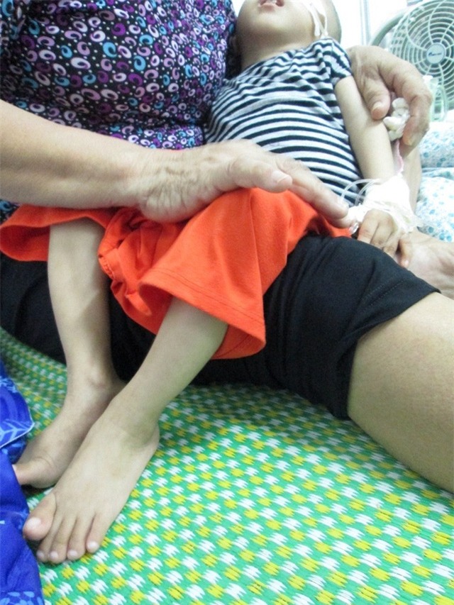 Toàn cơ thể Minh mềm yếu, hai chân và đôi tay đều tong teo... Ảnh: Nông Thuyết