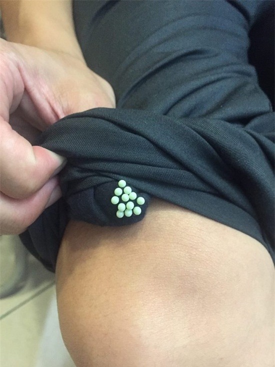 Rút quần áo phơi ngoài trời thấy hiện tượng này phải cẩn thận, có thể sẽ nguy hiểm đấy! - Ảnh 1.