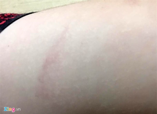 Dinh chi cong tac bao mau danh be trai 3 tuoi o Soc Trang hinh anh 2