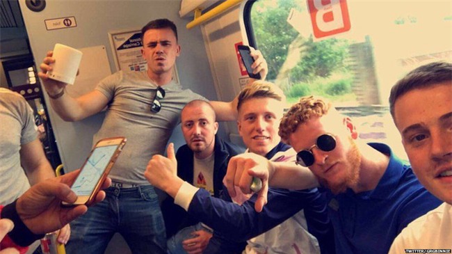 Nắng nóng kinh hoàng, chàng trai bị bỏng rộp nghiêm trọng khi làm việc ngoài trời suốt 7 tiếng - Ảnh 1.