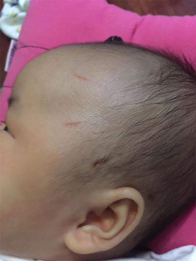Hà Nội: Mẹ bận trong bếp, khỉ bất ngờ trèo lan can vào nhà cào mặt con gái 2 tháng tuổi - Ảnh 1.