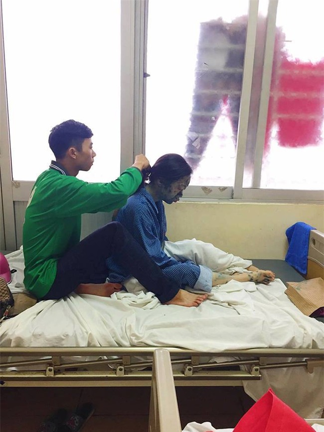 Bạn gái bị thủy đậu và hành động khiến dân mạng “dậy sóng” - Ảnh 1.