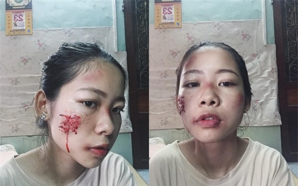 Sự thật về cô gái xinh xắn bị đánh ghen bầm dập khiến dân mạng xôn xao - Ảnh 1.