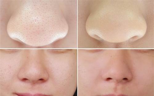 nuoc-soda-blogtamsuvn3