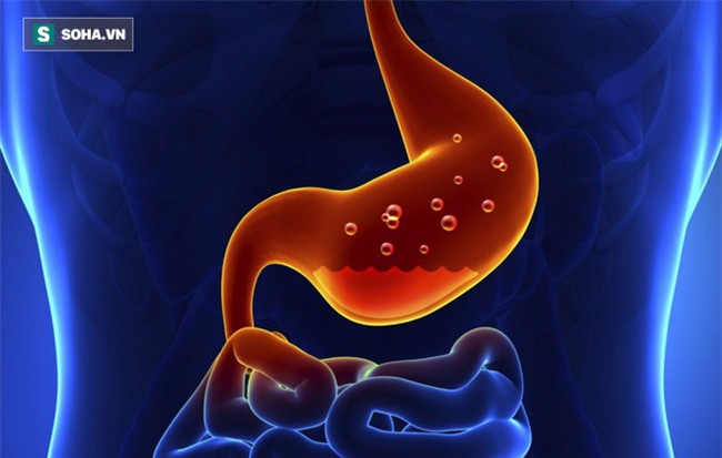 Danh y chia sẻ cách rửa sạch nội tạng: Không chỉ tôi, tất cả chúng ta đều nên làm ngay! - Ảnh 4.