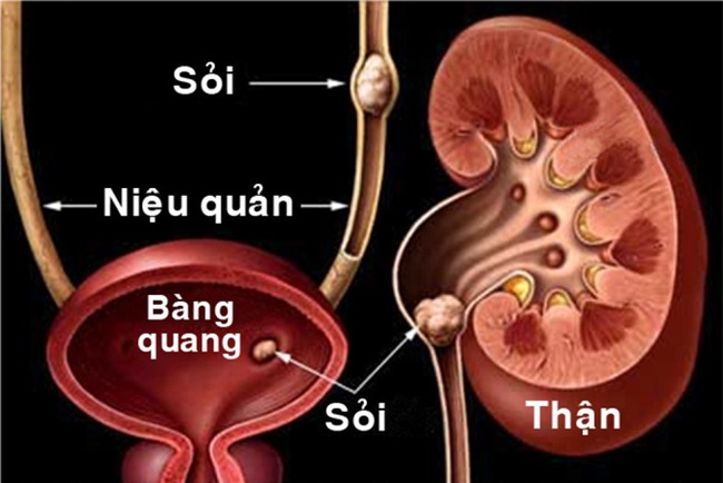 Danh y chia sẻ cách rửa sạch nội tạng: Không chỉ tôi, tất cả chúng ta đều nên làm ngay! - Ảnh 6.