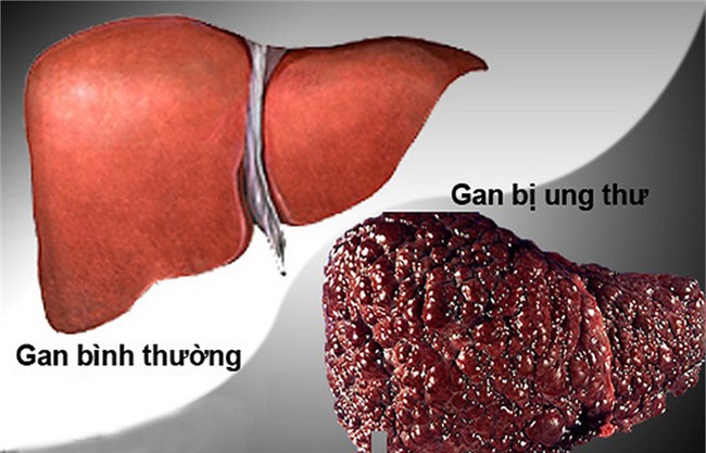 Danh y chia sẻ cách rửa sạch nội tạng: Không chỉ tôi, tất cả chúng ta đều nên làm ngay! - Ảnh 8.