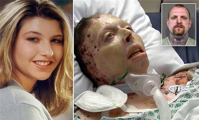 2 năm sau khi bị bạn trai tẩm xăng thiêu sống, người phụ nữ xinh đẹp đã qua đời - Ảnh 1.