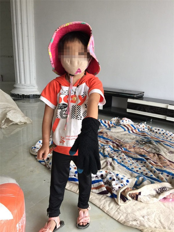 Bé gái 5 tuổi bị bỏng vì điện thoại phát nổ trong lúc ngủ, công ty điện thoại phớt lờ - Ảnh 3.