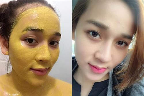 mat-na-chanh-nghe-blogtamsuvn3