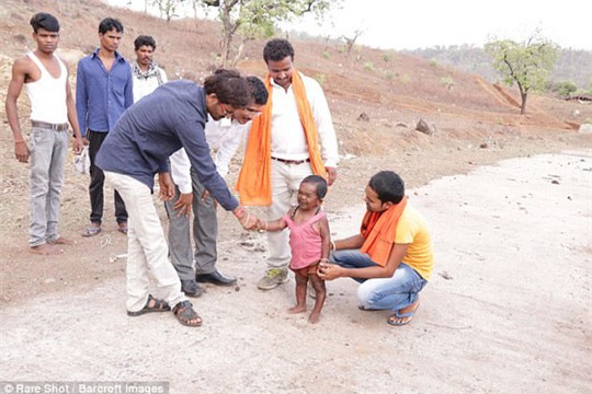 Người đàn ông 50 tuổi mắc kẹt trong cơ thể 5 tuổi - Ảnh 1.