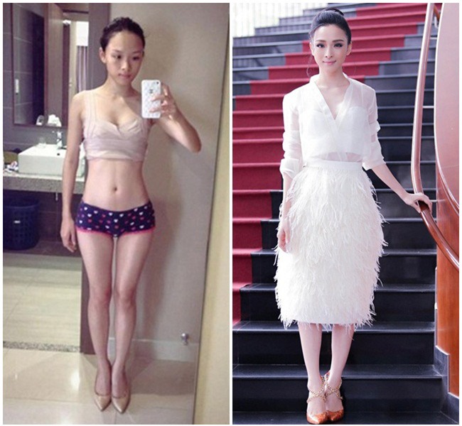 nhan sac that cua truong ho phuong nga truoc khi phau thuat tham my - 4