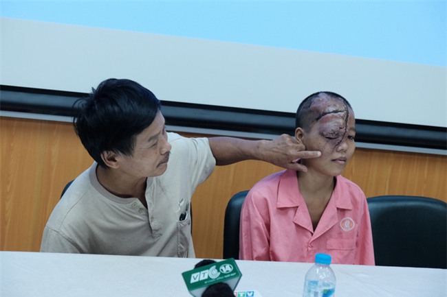 16 năm ròng, người cha chạy khắp Bắc - Nam tìm cách chữa bệnh cho con gái 21 tuổi có gương mặt dị biệt - Ảnh 5.