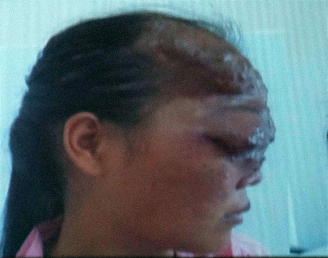 16 năm ròng, người cha chạy khắp Bắc - Nam tìm cách chữa bệnh  cho con gái 21 tuổi có gương mặt dị biệt - Ảnh 6.