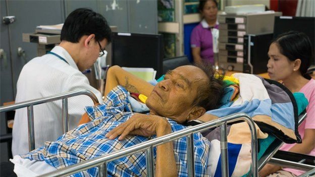 tu chuyen an ca song gay ung thu gan nen tu bo thoi quen an thuc pham song - 3